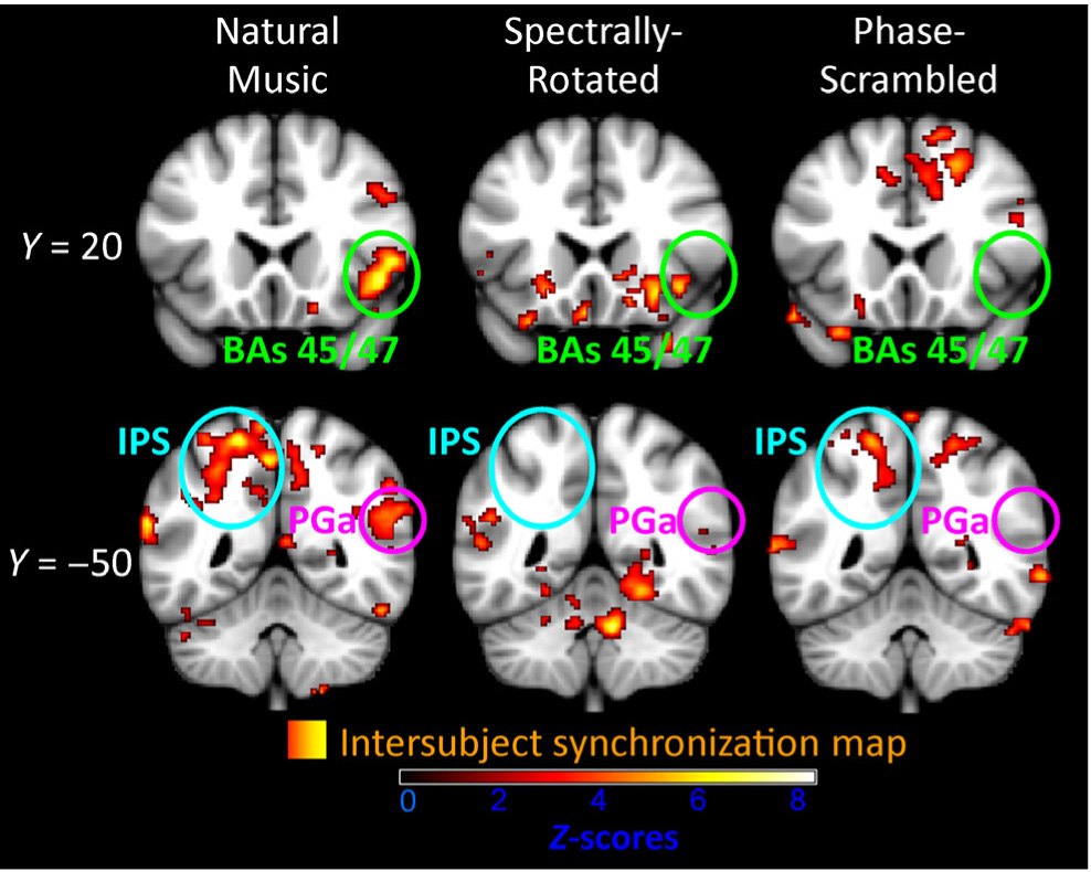 Scan of brains showing different areas highlighted. 